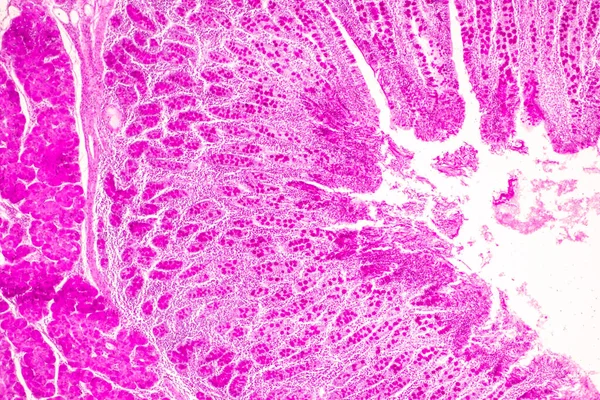 Dünndarmgewebe Duodenum Und Vermiformer Blinddarm Mensch Labor Unter Dem Mikroskop — Stockfoto
