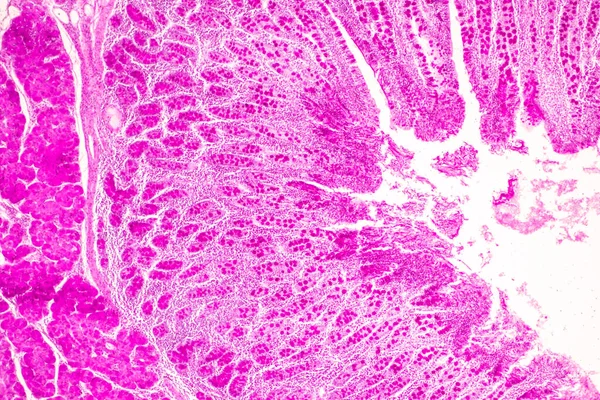 Tkáň Tenkého Střeva Duodenum Vermiform Appendix Human Pod Mikroskopem Laboratoři — Stock fotografie