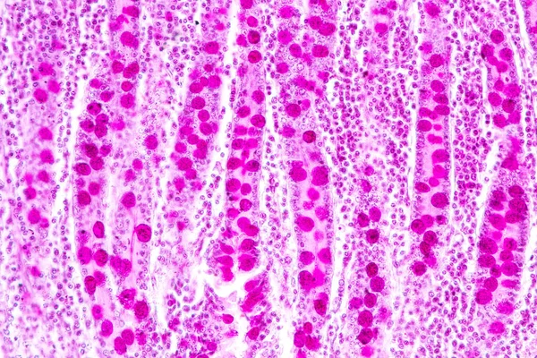 Tkanka Jelita Cienkiego Dwunastnicy Wyrostka Robaczkowego Człowieka Pod Mikroskopem Laboratorium — Zdjęcie stockowe