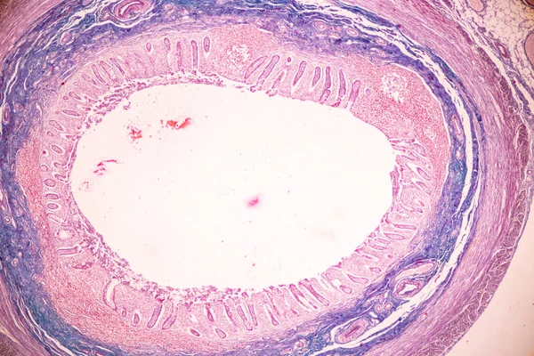 Tejido Intestino Delgado Duodeno Apéndice Vermiforme Humano Bajo Microscopio Laboratorio — Foto de Stock