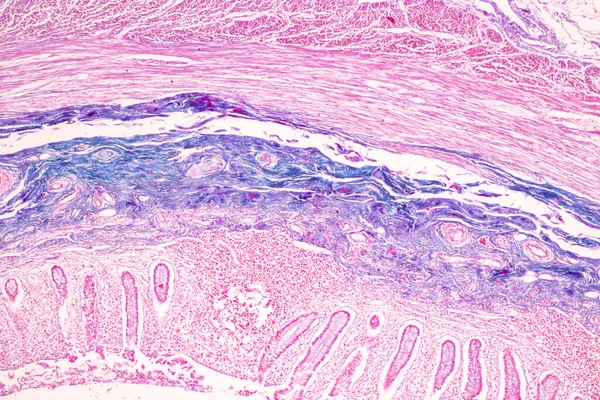 Weefsel Van Dunne Darm Duodenum Vermiform Appendix Human Onder Microscoop — Stockfoto