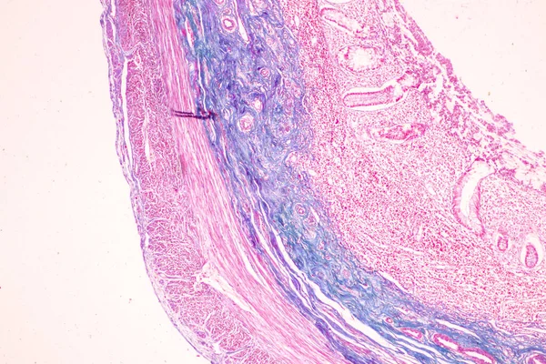 Tkáň Tenkého Střeva Duodenum Vermiform Appendix Human Pod Mikroskopem Laboratoři — Stock fotografie