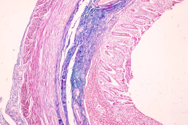 Vävnad Tunntarm Tolvfingertarmen Och Vermiform Blindtarm Människa Mikroskop Lab — Stockfoto