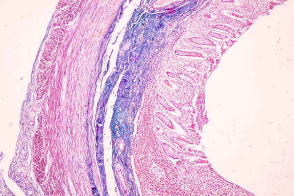 实验室显微镜下小肠组织 Duodenum 和畸形性阑尾的实验研究 — 图库照片