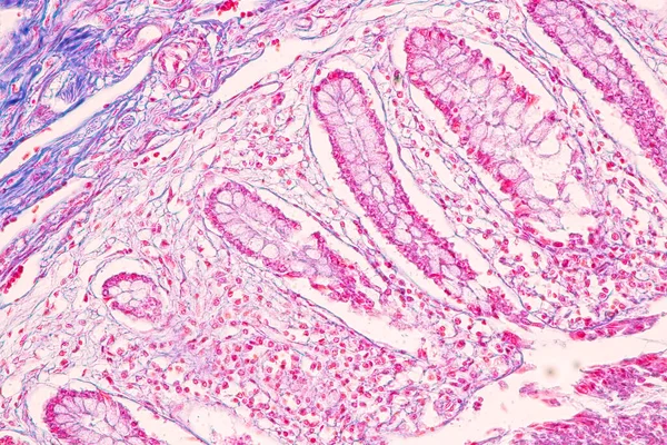 Tejido Intestino Delgado Duodeno Apéndice Vermiforme Humano Bajo Microscopio Laboratorio — Foto de Stock