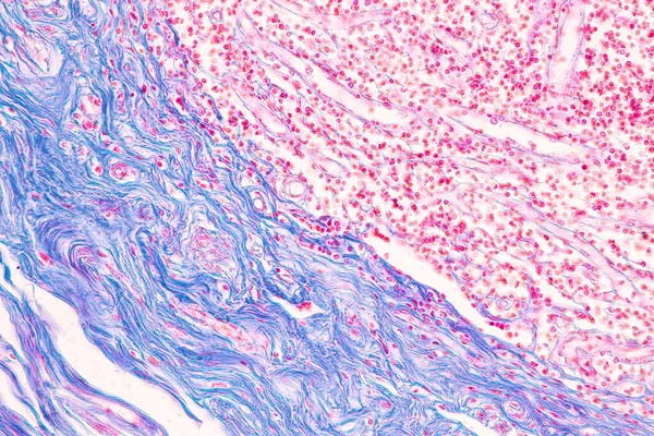小腸の組織 十二指腸 とベルミフォーム虫垂研究室の顕微鏡下でヒト — ストック写真