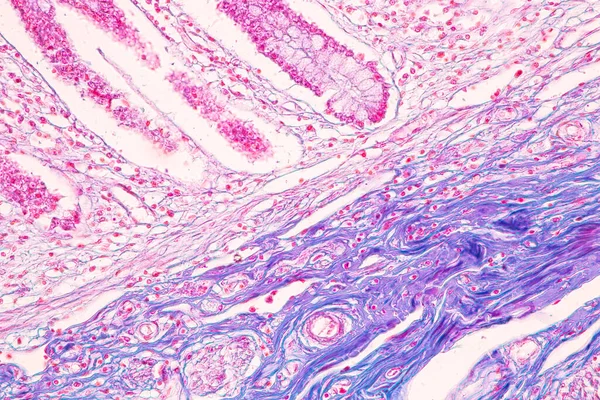 Laboratuvarda mikroskop altında İnce bağırsak (Duodenum) ve Vermiform Apandisit İnsanı dokusu.