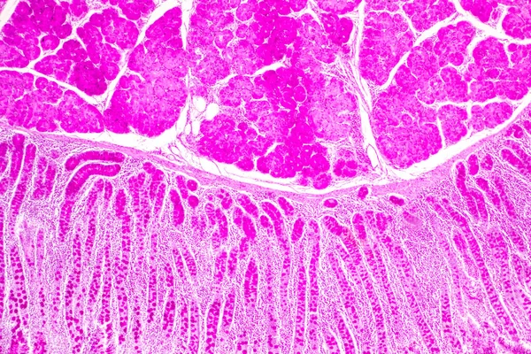 Dünndarmgewebe Duodenum Und Vermiformer Blinddarm Mensch Labor Unter Dem Mikroskop Stockbild