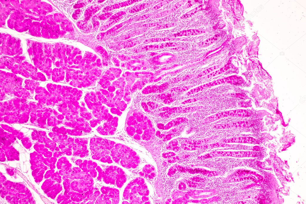 Tissue of Small intestine (Duodenum) and Vermiform appendix  Human under the microscope in Lab.