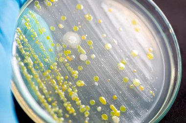 Özellikler ve Farklı şekilli Bakteri ve Küf Kolonisi mikrobiyoloji laboratuarındaki eğitim için toprak örneklerinden tarım plakalarında büyüyor..