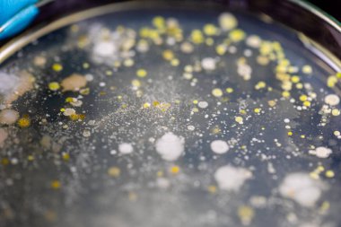 Özellikler ve Farklı şekilli Bakteri ve Küf Kolonisi mikrobiyoloji laboratuarındaki eğitim için toprak örneklerinden tarım plakalarında büyüyor..