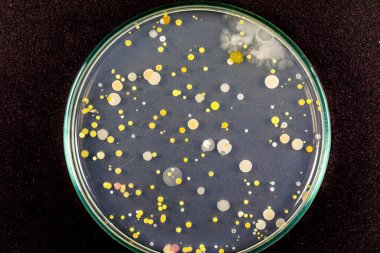 Özellikler ve Farklı şekilli Bakteri ve Küf Kolonisi mikrobiyoloji laboratuarındaki eğitim için toprak örneklerinden tarım plakalarında büyüyor..