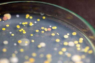 Özellikler ve Farklı şekilli Bakteri ve Küf Kolonisi mikrobiyoloji laboratuarındaki eğitim için toprak örneklerinden tarım plakalarında büyüyor..