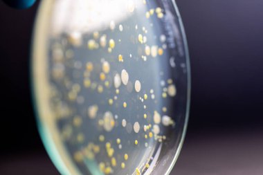 Özellikler ve Farklı şekilli Bakteri ve Küf Kolonisi mikrobiyoloji laboratuarındaki eğitim için toprak örneklerinden tarım plakalarında büyüyor..