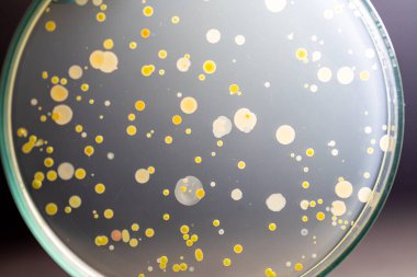 Özellikler ve Farklı şekilli Bakteri ve Küf Kolonisi mikrobiyoloji laboratuarındaki eğitim için toprak örneklerinden tarım plakalarında büyüyor..