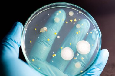 Özellikler ve Farklı şekilli Bakteri ve Küf Kolonisi mikrobiyoloji laboratuarındaki eğitim için toprak örneklerinden tarım plakalarında büyüyor..