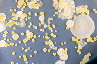 Özellikler ve Farklı şekilli Bakteri ve Küf Kolonisi mikrobiyoloji laboratuarındaki eğitim için toprak örneklerinden tarım plakalarında büyüyor..