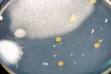 Özellikler ve Farklı şekilli Bakteri ve Küf Kolonisi mikrobiyoloji laboratuarındaki eğitim için toprak örneklerinden tarım plakalarında büyüyor..