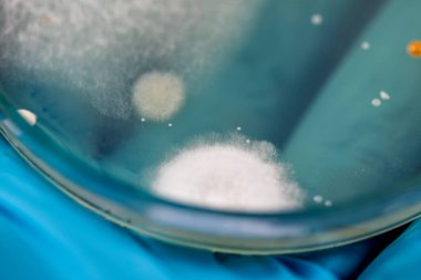 Özellikler ve Farklı şekilli Bakteri ve Küf Kolonisi mikrobiyoloji laboratuarındaki eğitim için toprak örneklerinden tarım plakalarında büyüyor..