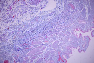 Laboratuvarda mikroskop altında insan safra kesesi kolon epitelyumu..