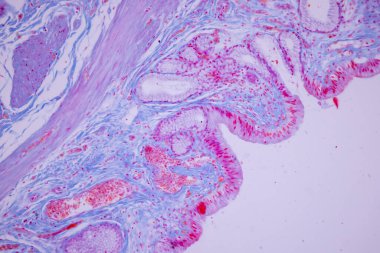 Laboratuvarda mikroskop altında insan safra kesesi kolon epitelyumu..