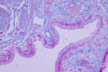 Laboratuvarda mikroskop altında insan safra kesesi kolon epitelyumu..