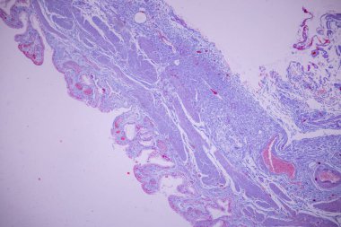 Laboratuvarda mikroskop altında insan safra kesesi kolon epitelyumu..