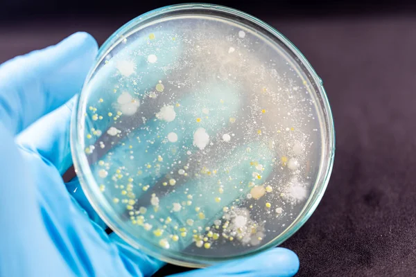 Tła Charakterystyczne Różnokształtna Kolonia Bakterii Pleśni Rosnąca Płytkach Agaru Próbek — Zdjęcie stockowe