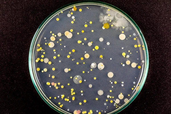 Özellikler ve Farklı şekilli Bakteri ve Küf Kolonisi mikrobiyoloji laboratuarındaki eğitim için toprak örneklerinden tarım plakalarında büyüyor..