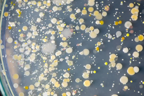 Antecedentes Características Diferentes Formas Colonia Bacterias Moho Que Crece Placas — Foto de Stock