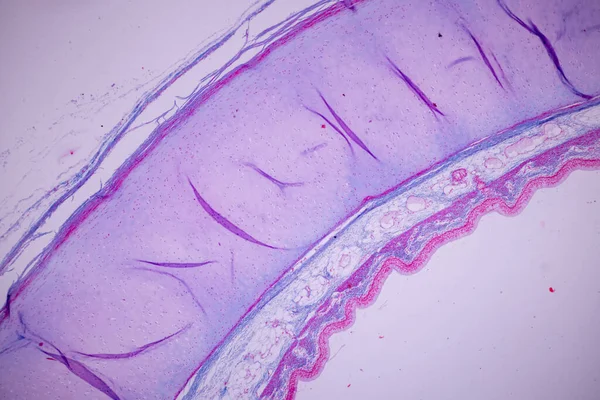 실험실에서 현미경 아래에 인간의 가슴에 — 스톡 사진
