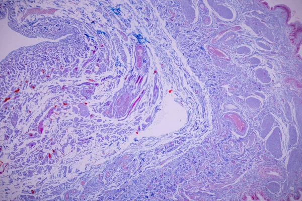 研究室の顕微鏡下におけるヒト胆嚢の円柱上皮 — ストック写真