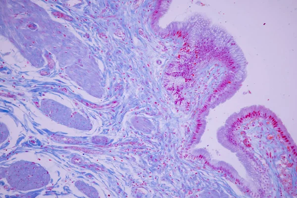 Epitelio Colonnare Della Cistifellea Umana Microscopio Laboratorio — Foto Stock