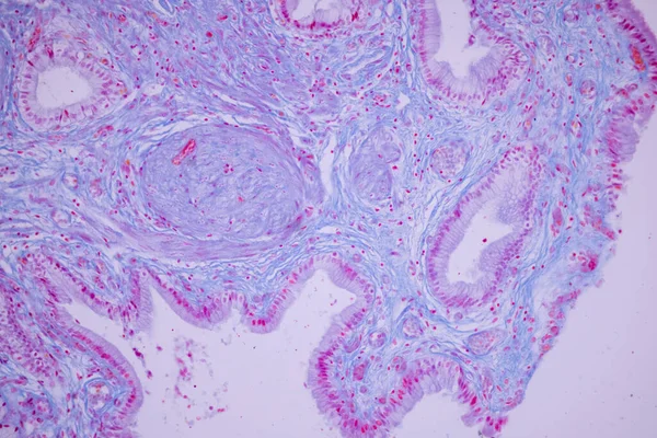 研究室の顕微鏡下におけるヒト胆嚢の円柱上皮 — ストック写真