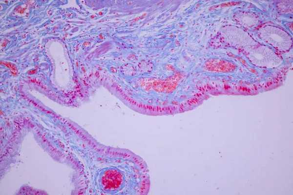 Sloupcové Epitelum Lidského Žlučníku Pod Mikroskopem Laboratoři — Stock fotografie