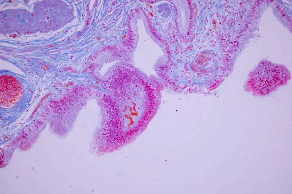 Sloupcové Epitelum Lidského Žlučníku Pod Mikroskopem Laboratoři — Stock fotografie