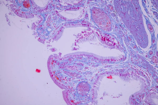 Epitelium Columnar Dari Kantung Empedu Manusia Bawah Mikroskop Lab — Stok Foto