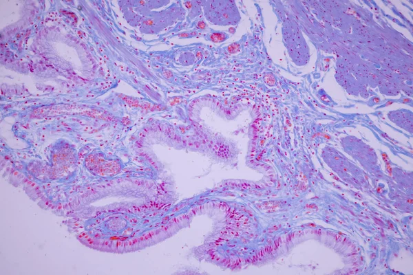 Kolomepitheel Van Menselijke Galblaas Onder Microscoop Lab — Stockfoto