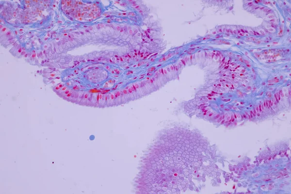 Columnar Epithelium Human Gall Bladder Microscope Lab — Stock Photo, Image