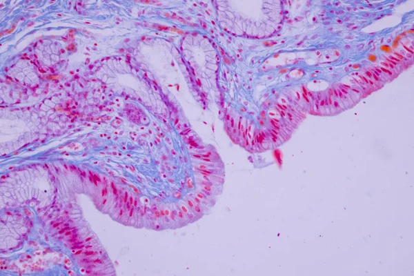 Epitelium Columnar Dari Kantung Empedu Manusia Bawah Mikroskop Lab — Stok Foto