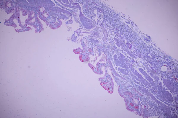 实验室显微镜下人体胆囊柱状上皮 — 图库照片