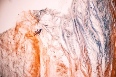 Laboratuvarda mikroskop altında insan kıkırdağı..