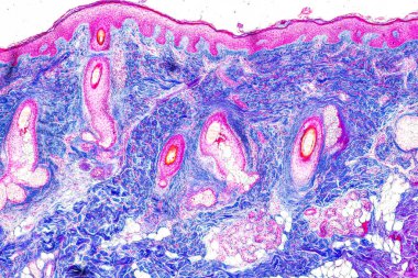 Laboratuvarda mikroskop altında insan derisi ve saç kökleri..