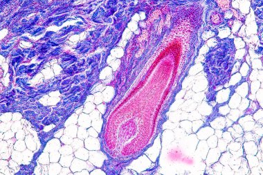 Laboratuvarda mikroskop altında insan derisi ve saç kökleri..