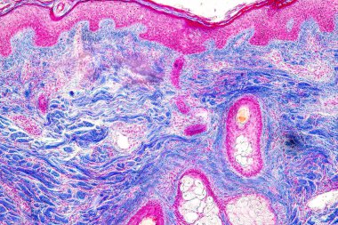 Laboratuvarda mikroskop altında insan derisi ve saç kökleri..