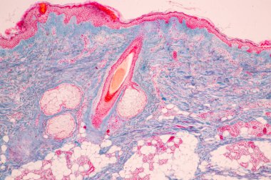 Laboratuvarda mikroskop altında insan derisi ve saç kökleri..