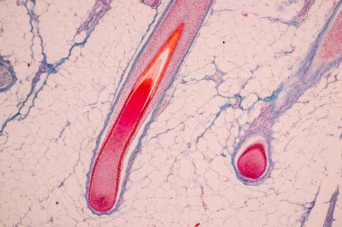 Scalp and hair follicles of human under the microscope in Lab. clipart