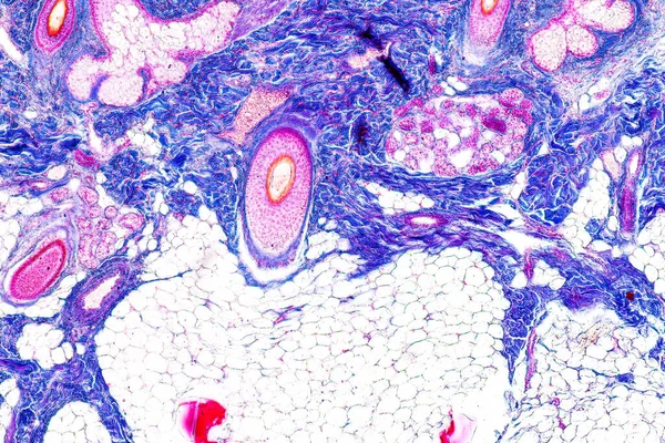 Scalp and hair follicles of human under the microscope in Lab.