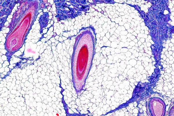 Scalp and hair follicles of human under the microscope in Lab.