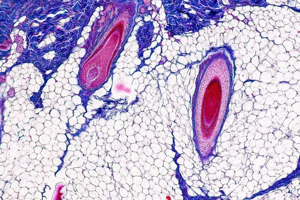 Scalp Hair Follicles Human Microscope Lab — Stok Foto
